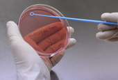 Wissenschaftler verwenden DNA-Untersuchung, um Ruhrbakterien nachzuweisen