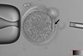 Embryonale Stammzellen werden das erste Mal unter Verwendung der Zellen von Erwachsenen geklont