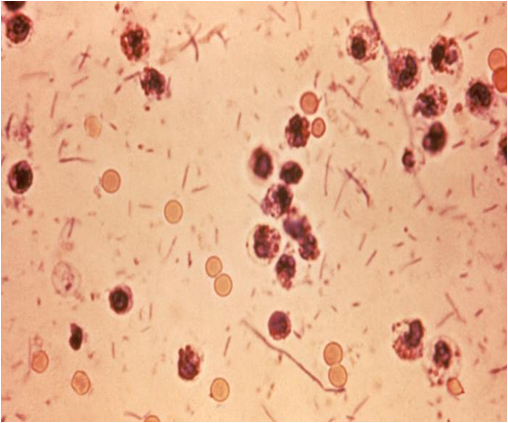 세균성이질균 ‘시겔라 소네이’(Shigella Sonnei)를 현미경으로 확대한 모습 (사진: 농촌진흥청) 